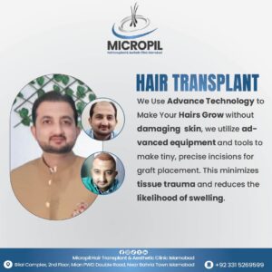 Hair transplant5-01